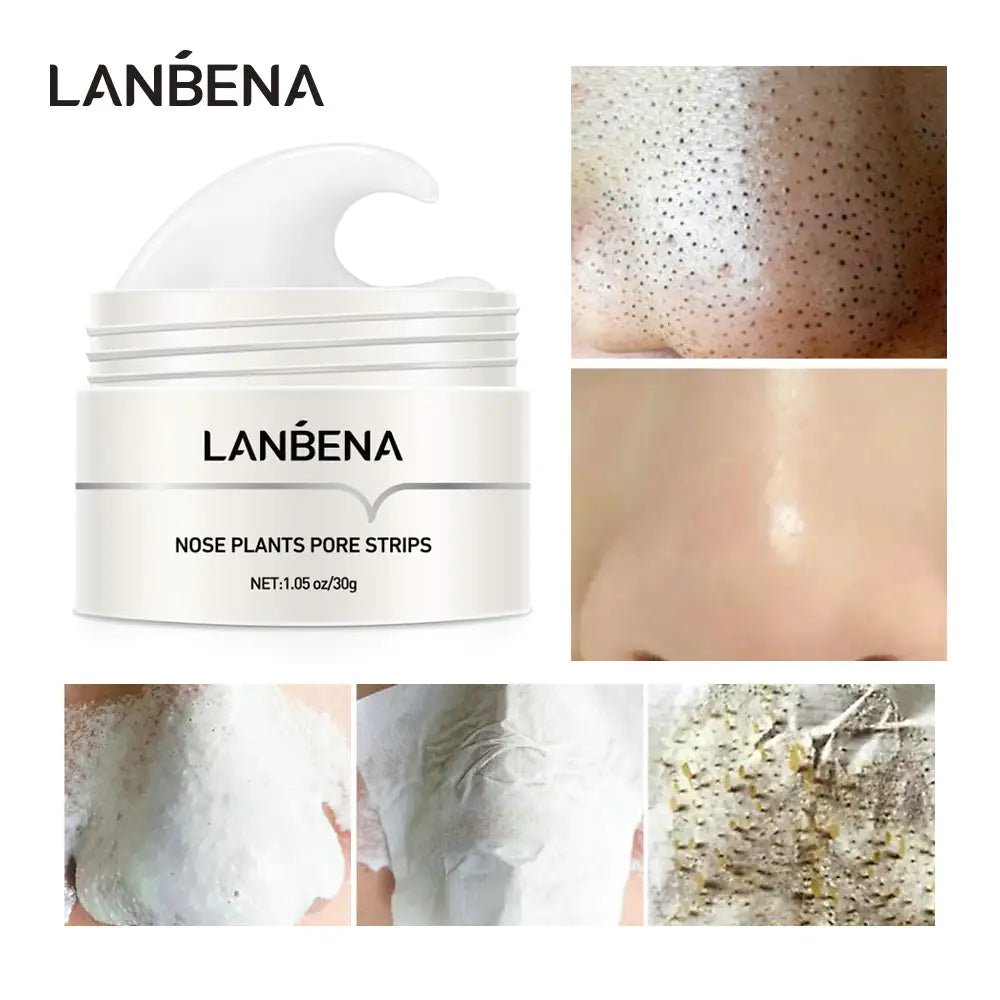 Blackhead Remover Mask - SavageBiz