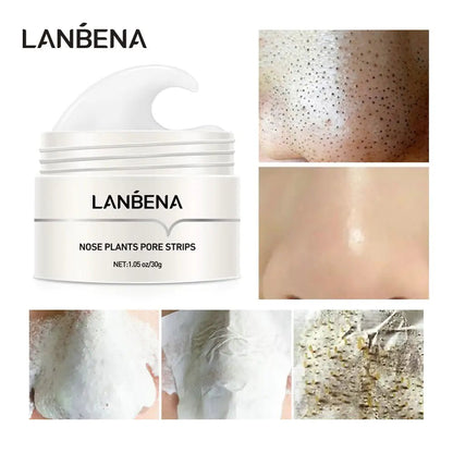 Blackhead Remover Mask - SavageBiz