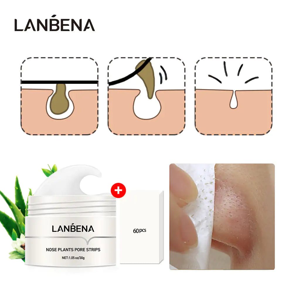 Blackhead Remover Mask - SavageBiz