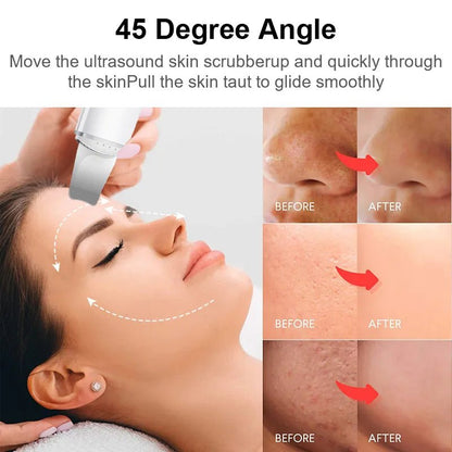 Ultrasonic Facial Enhancer - SavageBiz